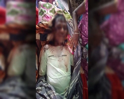 बौखलाहट में कायराना हरकत : नक्सलियों ने मुखबिरी के शक में की युवक की हत्या, इधर जंगल में IED की चपेट में आने से ग्रामीण हुआ घायल