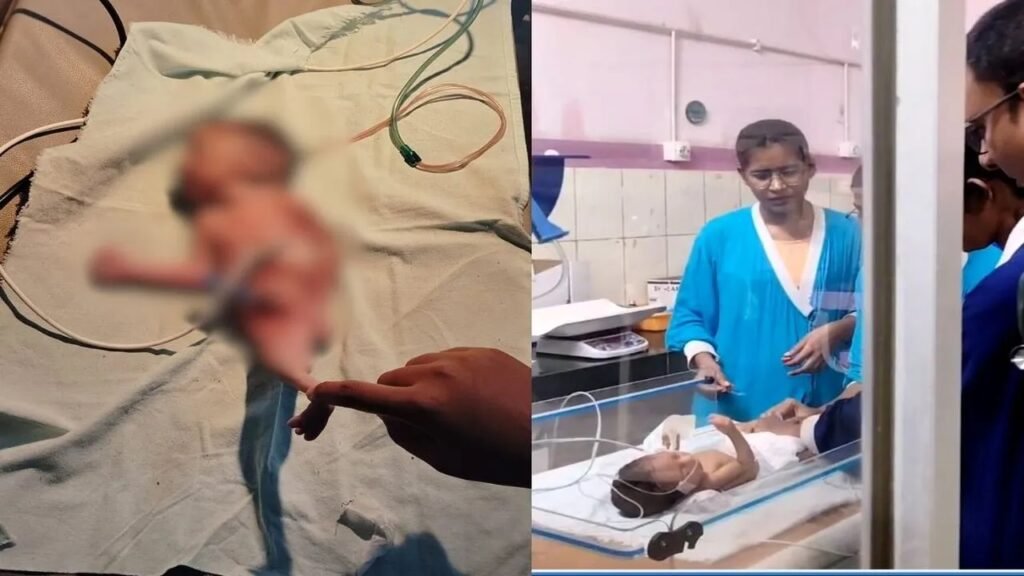 जिला अस्पताल में जन्मा जलपरी जैसा शिशु, डॉक्टर और स्टाफ भी रह गए दंग