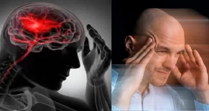 Stroke Symptoms: स्ट्रोक का खतरा? सुबह-सुबह दिखने वाले लक्षणों पर ध्यान दें, न करें इग्नोर