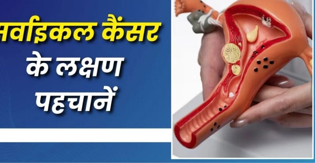 सर्वाइकल कैंसर
