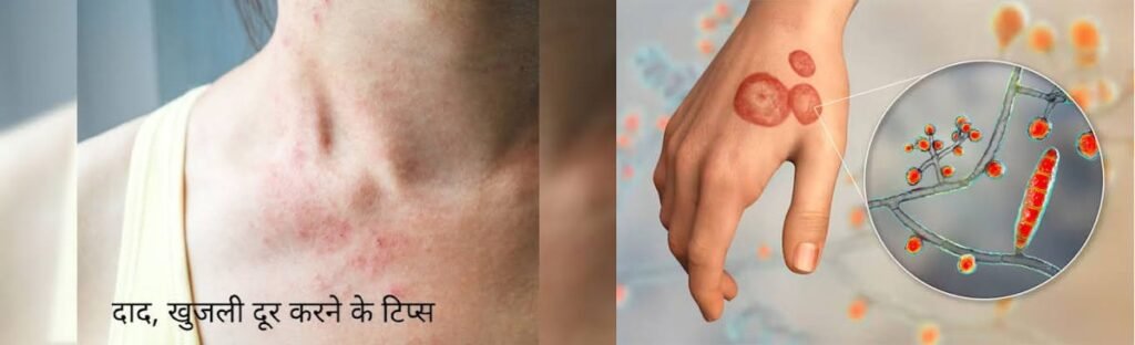 Fungal Infection: बारिश के बाद बढ़ा दाद-खाज का खतरा, एंटीफंगल रेजिस्टेंस क्यों बढ़ रही?