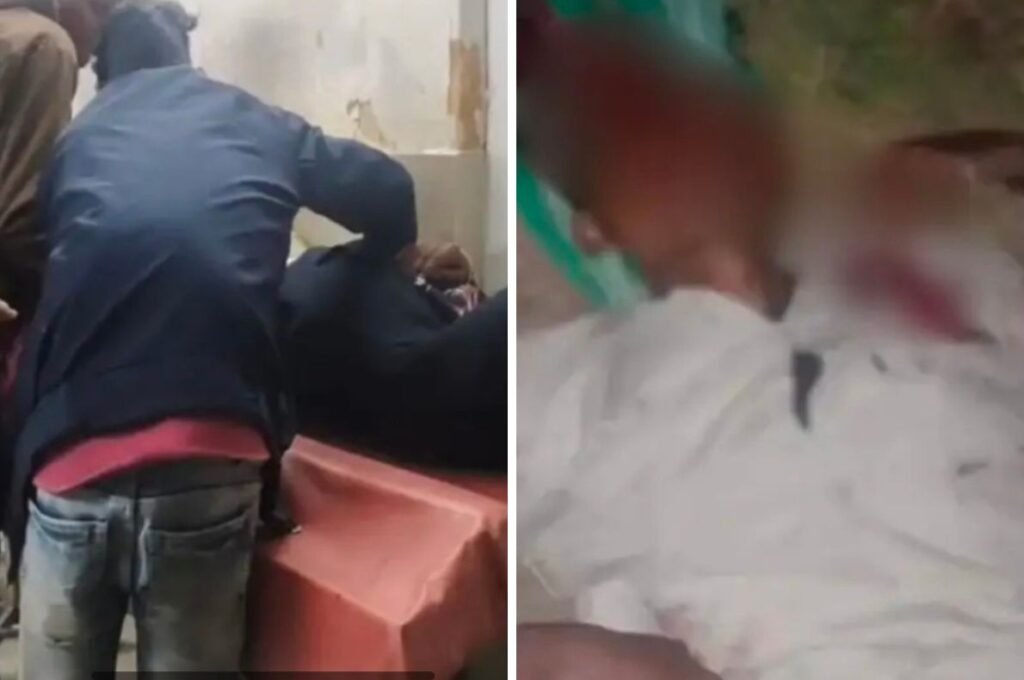 Ambikapur Accident: दर्दनाक सड़क हादसे में बाइक सवार की मौत, साथी गंभीर; हेलमेट नहीं पहनना भी बना चिंता का विषय