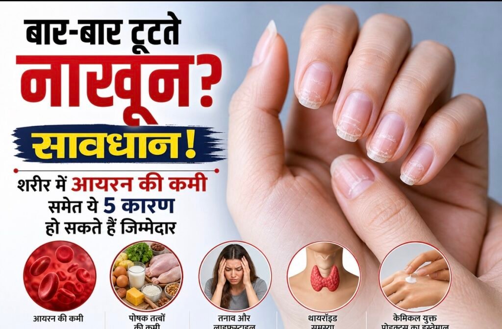 बार-बार टूटते नाखून? सावधान! शरीर में आयरन की कमी समेत ये 5 कारण हो सकते हैं जिम्मेदार